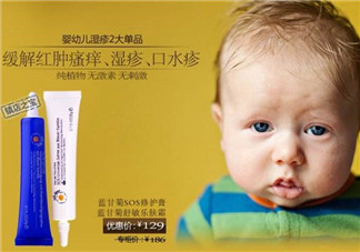 恩姆花園濕疹膏有激素嗎？恩姆花園濕疹膏含不含激素？