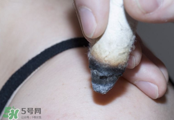 艾灸后為什么會(huì)癢？艾灸后為什么要多喝水