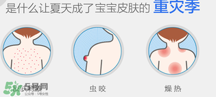 妙思樂爽膚水好用嗎？妙思樂爽膚水能去痱嗎？