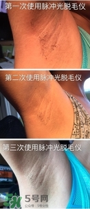 松下es wh93脫毛儀怎么樣？松下es wh93脫毛儀多少錢