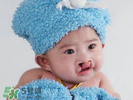 兔唇可以治嗎？兔唇修補術(shù)