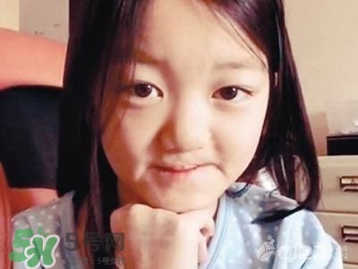 兔唇是什么？兔唇是什么原因造成的？