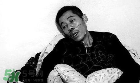 塵肺病吃什么藥能清肺？塵肺病國(guó)家有什么政策