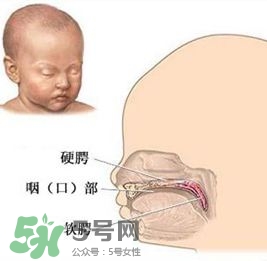 兔唇能檢查出來嗎？兔唇能完全修復(fù)嗎？
