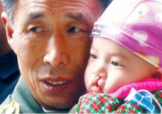 兔唇是什么？兔唇是什么原因造成的？
