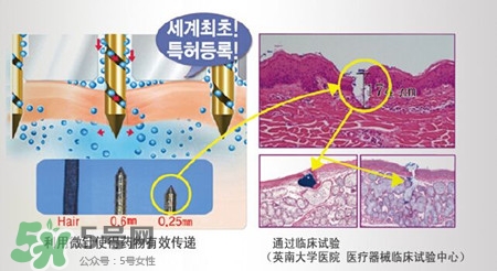 珠兒麗蚊子針好用嗎？珠兒麗蚊子針副作用