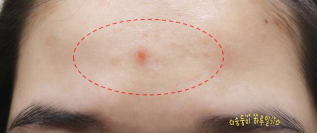 real skin patch怎么樣？real skin是什么牌子