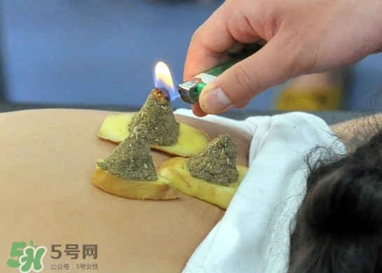 三伏灸灸哪里？三伏灸是每天都灸嗎
