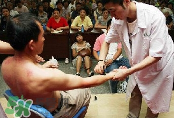 刮痧痛嗎？刮痧疼還是拔罐疼