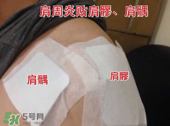 艾灸貼多少錢一盒?？艾灸貼一盒60裝多少錢？