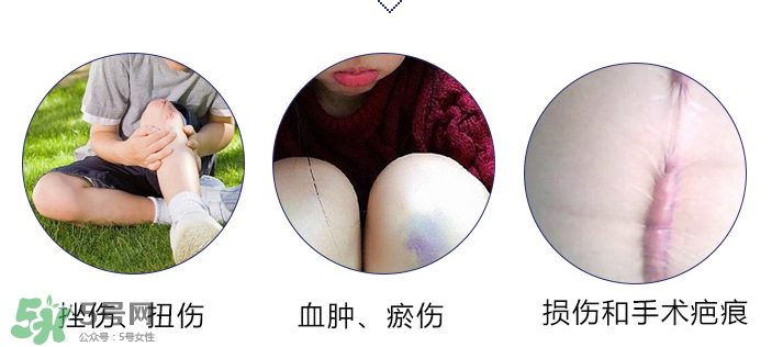hirudoid除疤膏有效嗎？hirudoid去疤膏效果如何？