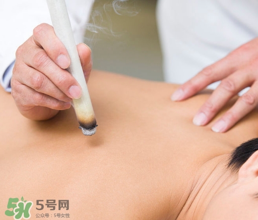 三伏貼和艾灸哪個(gè)好？三伏貼和艾灸區(qū)別