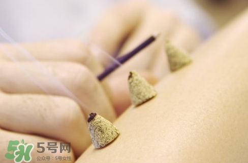 三伏貼和艾灸哪個(gè)好？三伏貼和艾灸區(qū)別