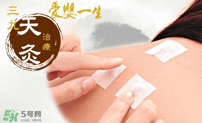 貼三伏貼掛什么科？三伏貼掛什么號(hào)？