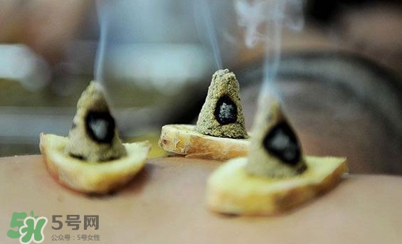 貼三伏貼可以艾灸嗎？貼三伏貼多久可以艾灸