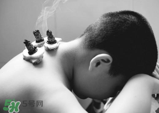 三伏灸什么人不能做？三伏灸適合哪些人？