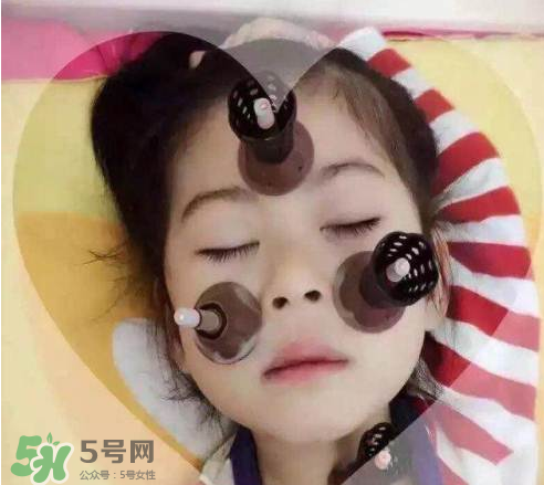 艾灸貼可以治咳嗽嗎？艾灸貼可以治退燒嗎？