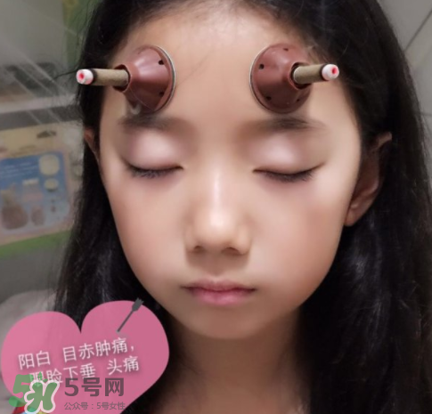 艾灸貼可以治咳嗽嗎？艾灸貼可以治退燒嗎？