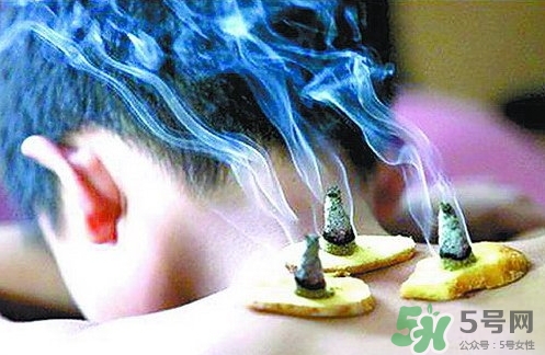 三伏灸什么時(shí)候開始灸？三伏灸怎么灸？