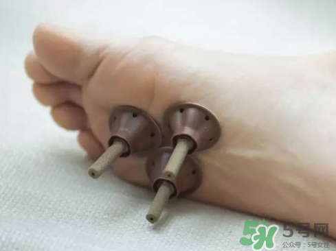 艾艾貼灸出水珠為什么？艾艾貼后有水珠要擦嗎？