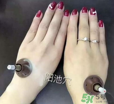 艾艾貼灸出水珠為什么？艾艾貼后有水珠要擦嗎？