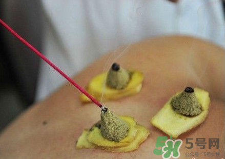 三伏灸可以自己灸嗎？三伏灸可以在家做嗎？
