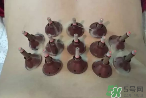 艾艾貼可以貼肚臍眼嗎？艾艾貼貼肚臍有什么作用？