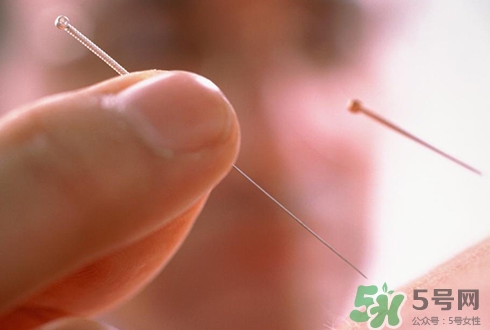針灸可以治療失眠嗎？失眠時(shí)針灸哪些穴位有效