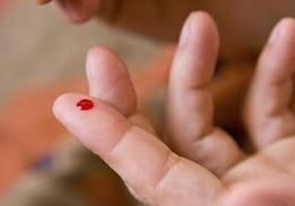 放血療法能治濕氣重嗎？放血療法治病的原理是什么