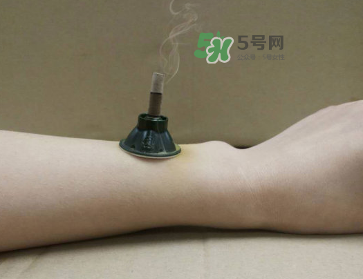 三伏天下雨可以艾灸嗎？三伏天下雨艾灸好嗎？