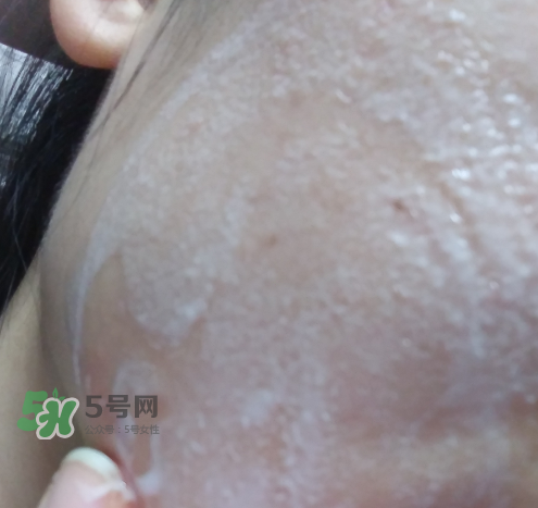 貝蜜清凈痘控油潔面啫喱怎么樣？貝蜜清祛痘控油潔面啫喱好用嗎？