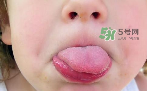 三伏天為什么濕氣重？三伏天為什么要注意祛濕？