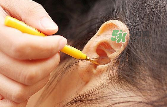兒童耳屎成硬塊怎么辦？?jī)和撼捎矇K有危害嗎？
