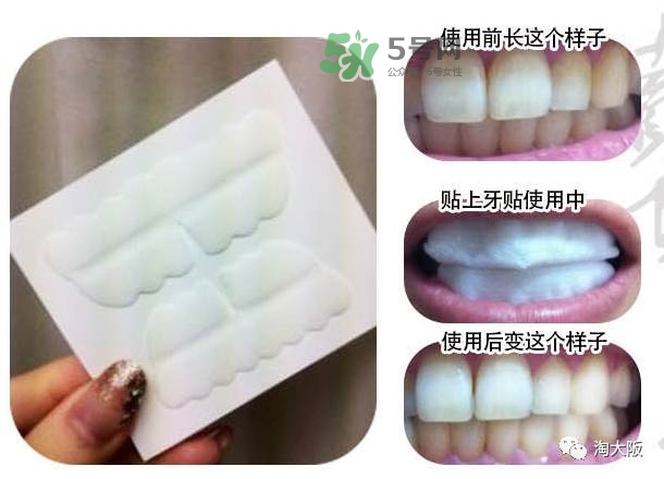 smile cosmetique牙貼怎么樣_有效果嗎_多少錢(qián)