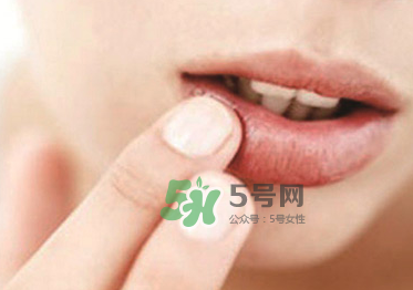 你的嘴唇為什么起泡 嘴唇上的水泡治不好嗎？
