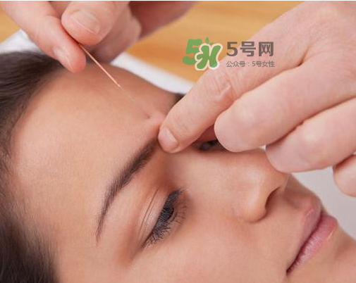 三伏天針灸有什么好處？三伏天針灸注意什么？