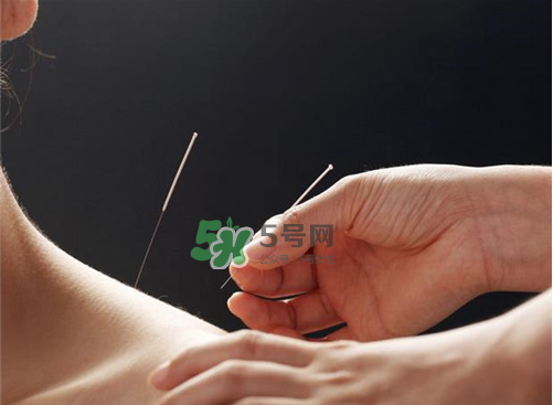 三伏天針灸有什么好處？三伏天針灸注意什么？
