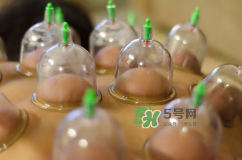 拔火罐是夏天好還是冬天好？什么時(shí)候拔火罐最合適？