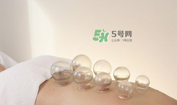 拔火罐是夏天好還是冬天好？什么時(shí)候拔火罐最合適？
