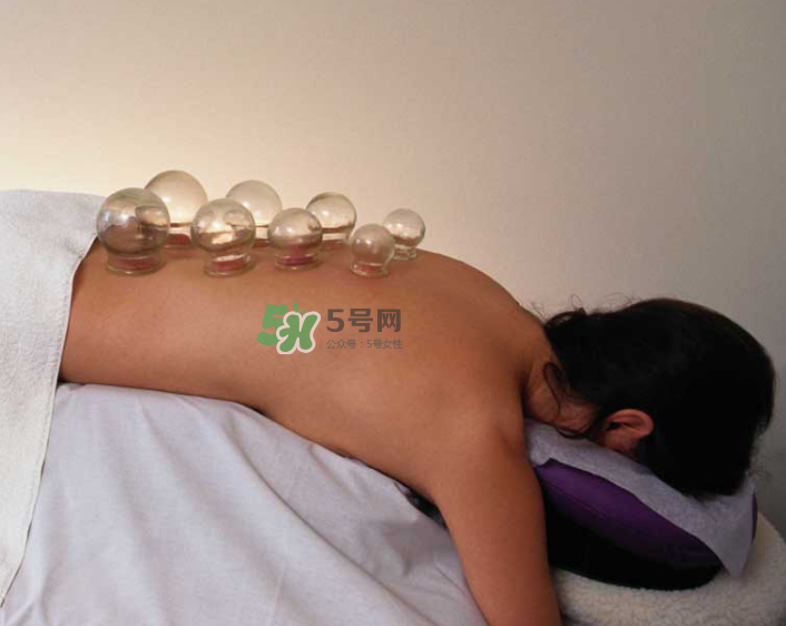 拔火罐一次多長時間？拔火罐一般多長時間？