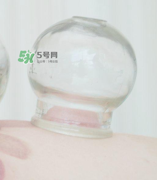 拔火罐一次多長時間？拔火罐一般多長時間？