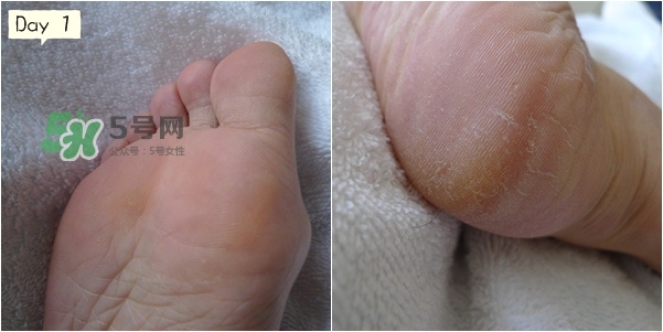 baby foot足膜怎么用？baby foot足膜使用方法