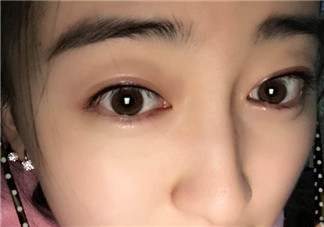 做美瞳線會(huì)不會(huì)掉睫毛？做美瞳線掉睫毛怎么辦？