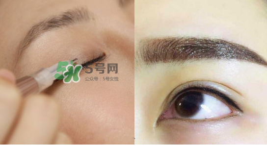 美瞳線有必要做嗎？做美瞳線多少錢(qián)？