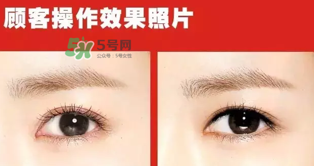 美瞳線有必要做嗎？做美瞳線多少錢(qián)？