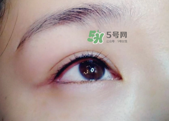 做美瞳線疼嗎？做美瞳線后要注意什么？