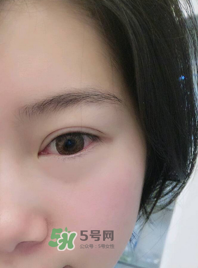 做美瞳線疼嗎？做美瞳線后要注意什么？
