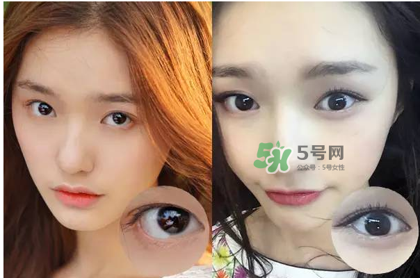 做美瞳線會(huì)不會(huì)掉睫毛？做美瞳線掉睫毛怎么辦？