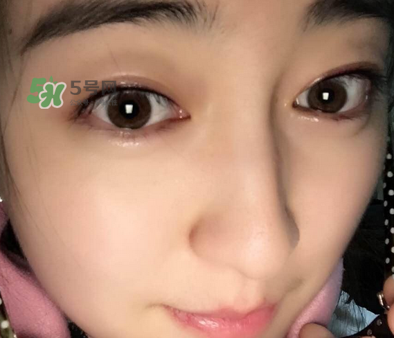 做美瞳線可以喝酒嗎？做美瞳線喝酒有影響嗎？