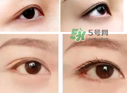 做美瞳線可以吃雞蛋嗎？做美瞳線能吃雞蛋嗎？